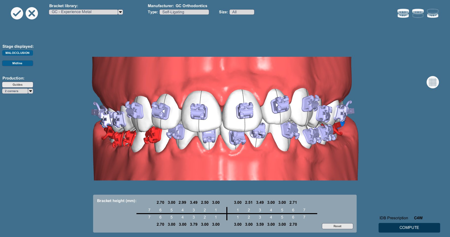 IDB malocclusion