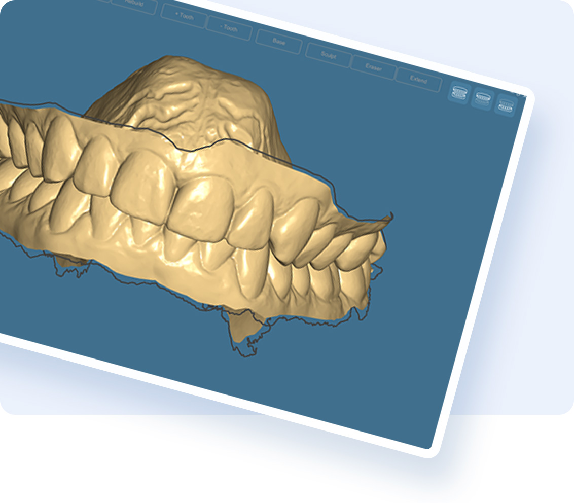 Mesh reconstruction