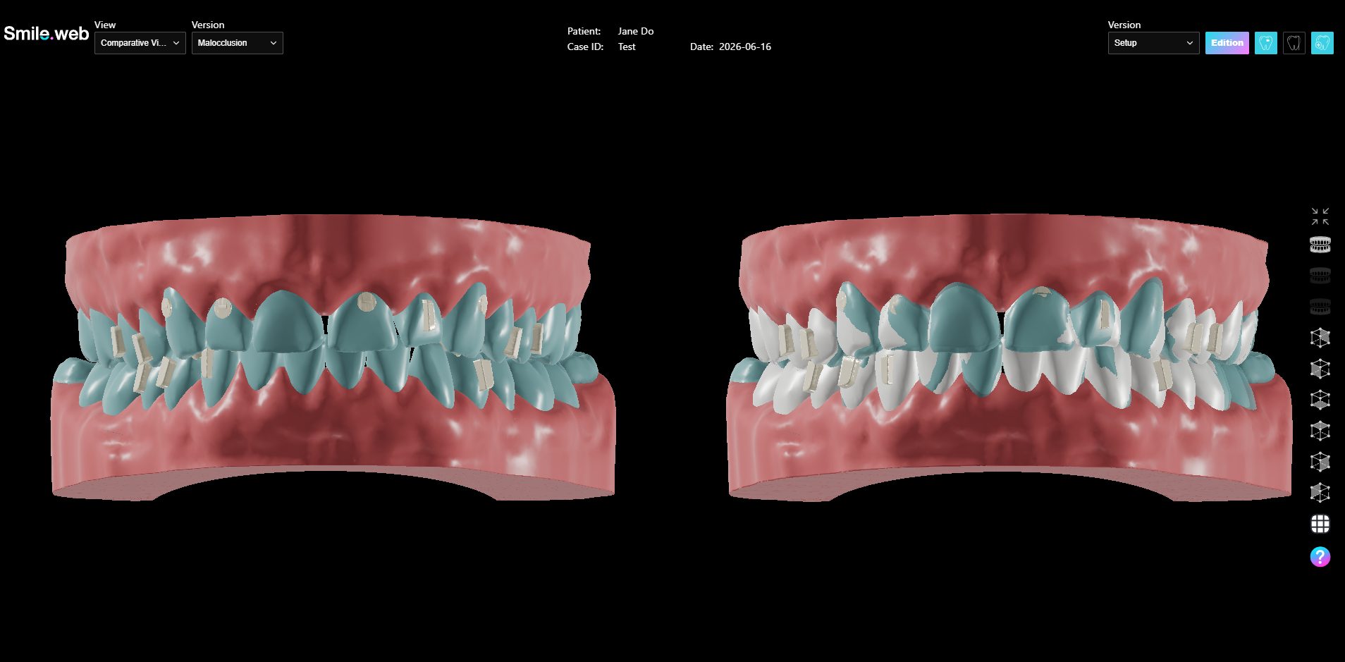 comparison view